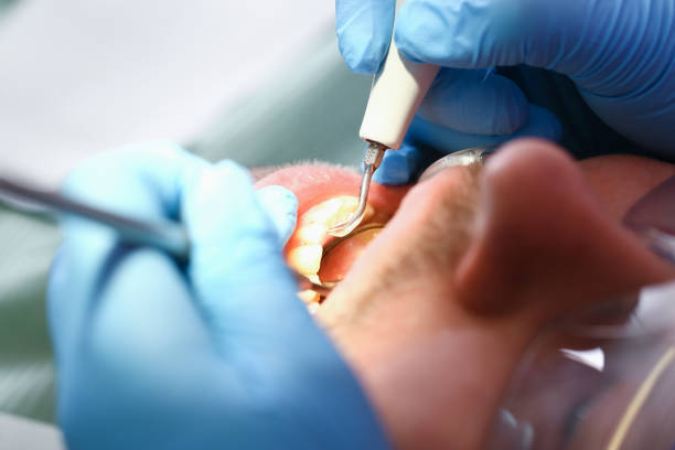 Best Emergency Dental Surgery in North Cape May, NJ