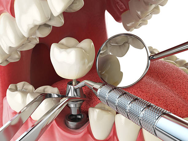 Best Emergency Dental Care for Trauma or Injury in North Cape May, NJ